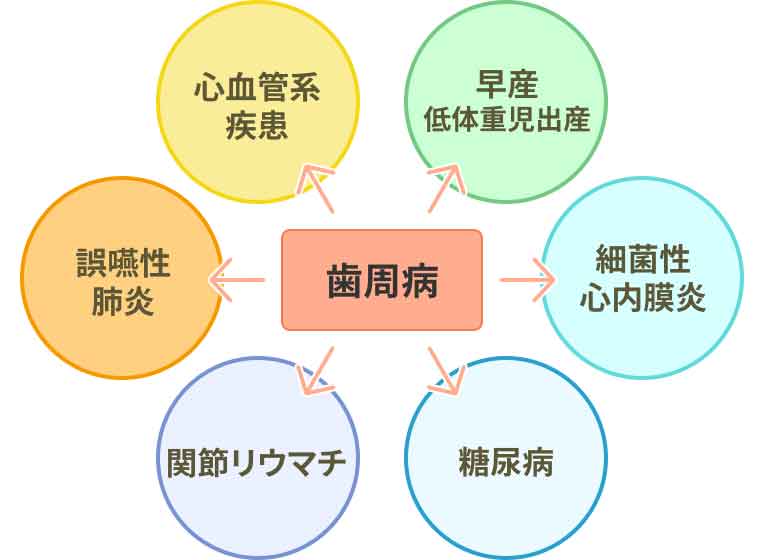 歯周病治療(歯槽膿漏の治療)