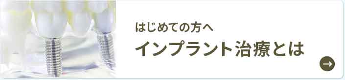 インプラント治療とは