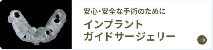 インプラント ガイドサージェリー